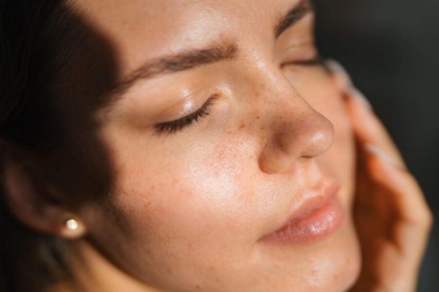 Restylane Storage RESTYLANE in Phoenix, AZ | Solara Health & Beauty